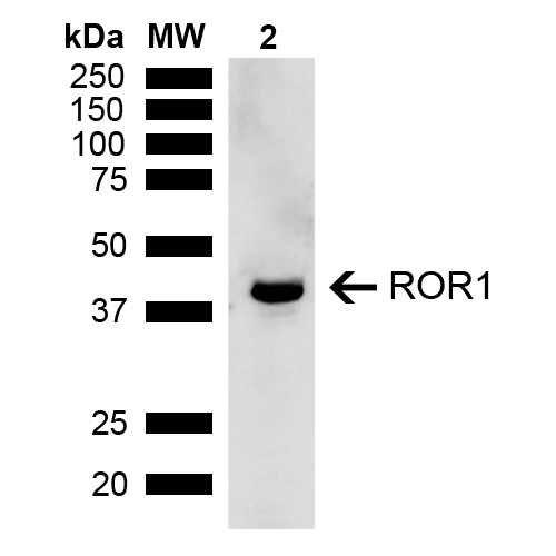  - ROR1 Antibody ASM10611
